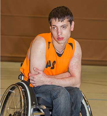 Rheumatoid Arthritis and Physical Activity
